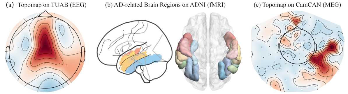 Occlusion maps for TUAB EEG, ADNI fMRI, and CamCAN MEG